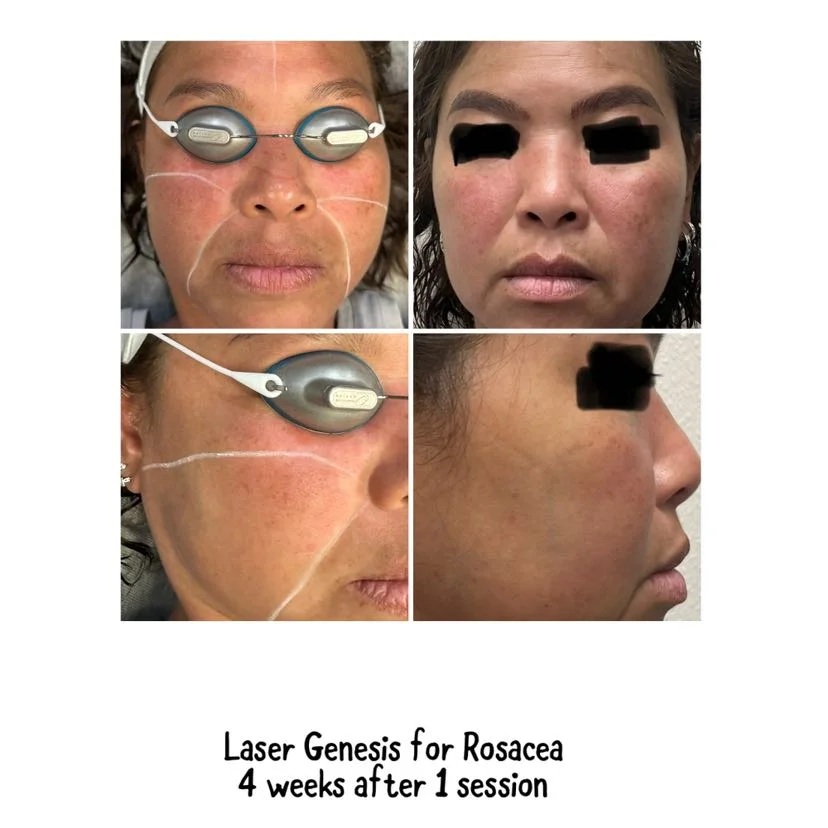 Dailyglowspa_Before_and_After_Image_Three_in_San_Diego_CA