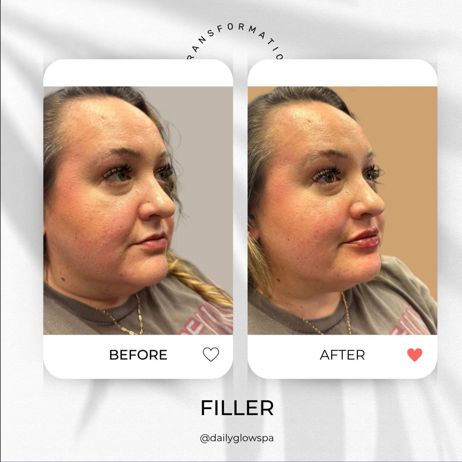 before and after