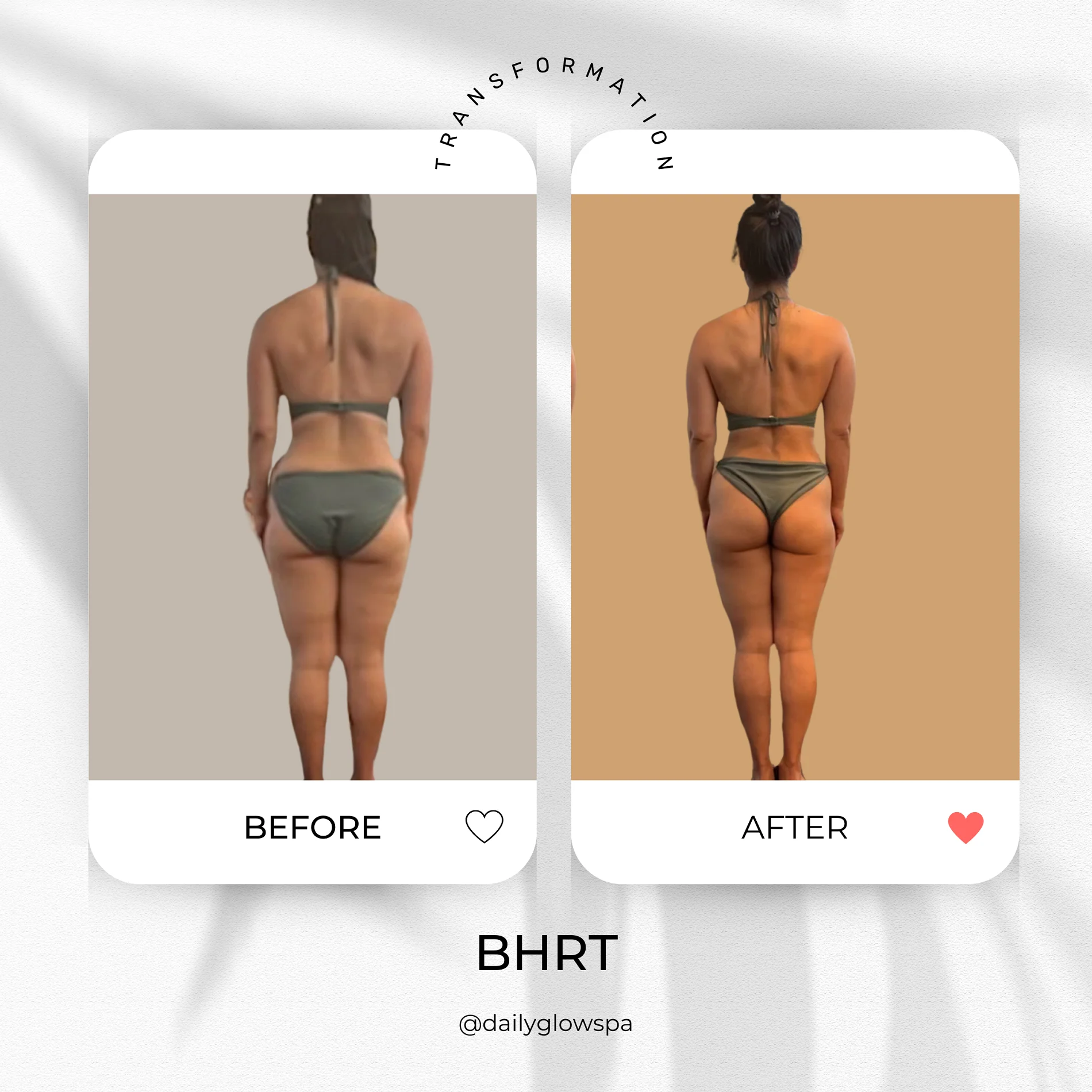 Dailyglowspa_Before_and_After_BHRT_Three_in_San_Diego_CA