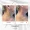 Dailyglowspa_Before_and_After_Body_Contouring_Two_in_San_Diego_CA