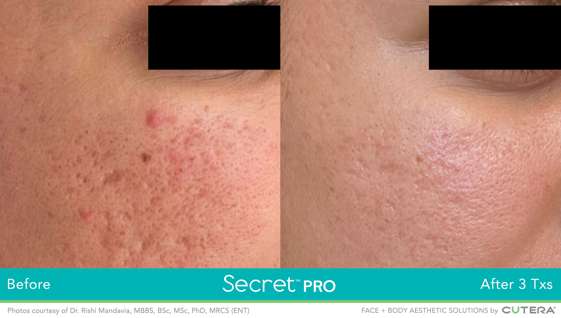 50_Secret-Pro_B&A_Rishi