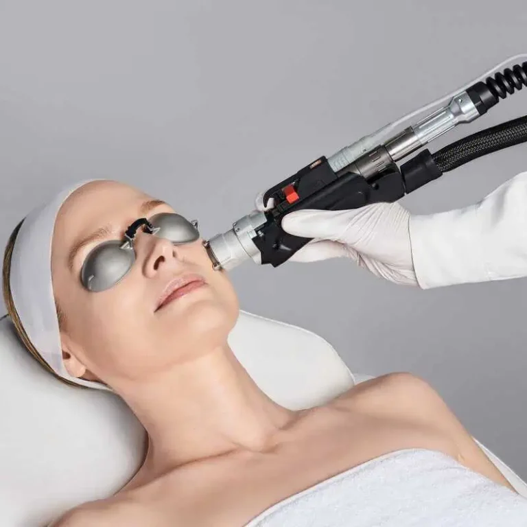 laser-hair-removal